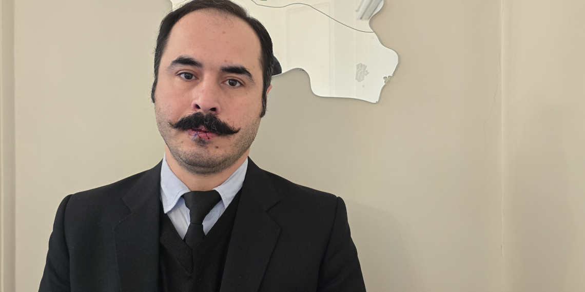 لبی که با خودکار دوخته شد و کسبی که دیگر رونق ندارد